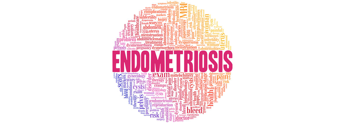 No-Cost Endometriosis Research Study