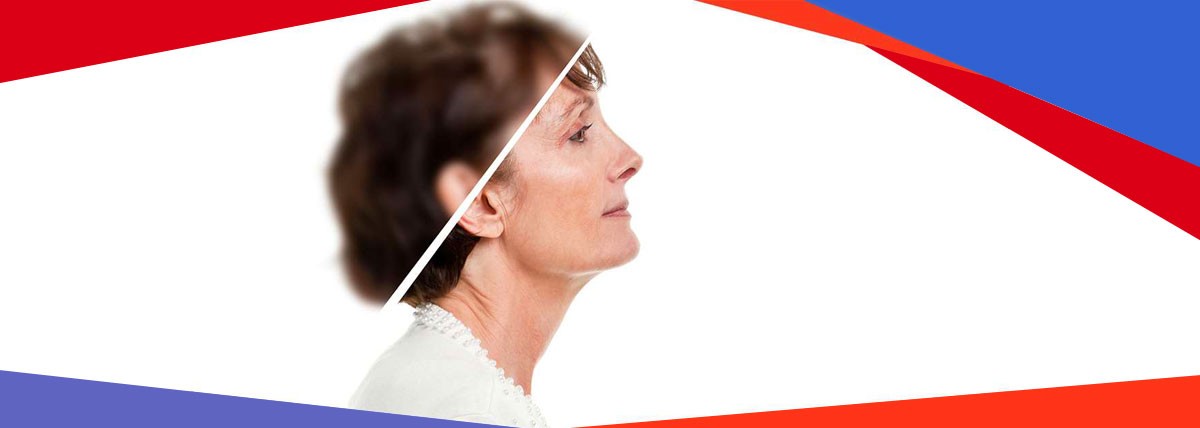 Cluster Headaches